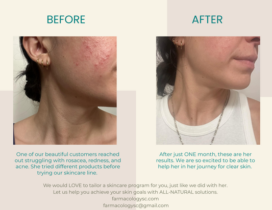 Before and After All-Natural Skincare that WORKS!