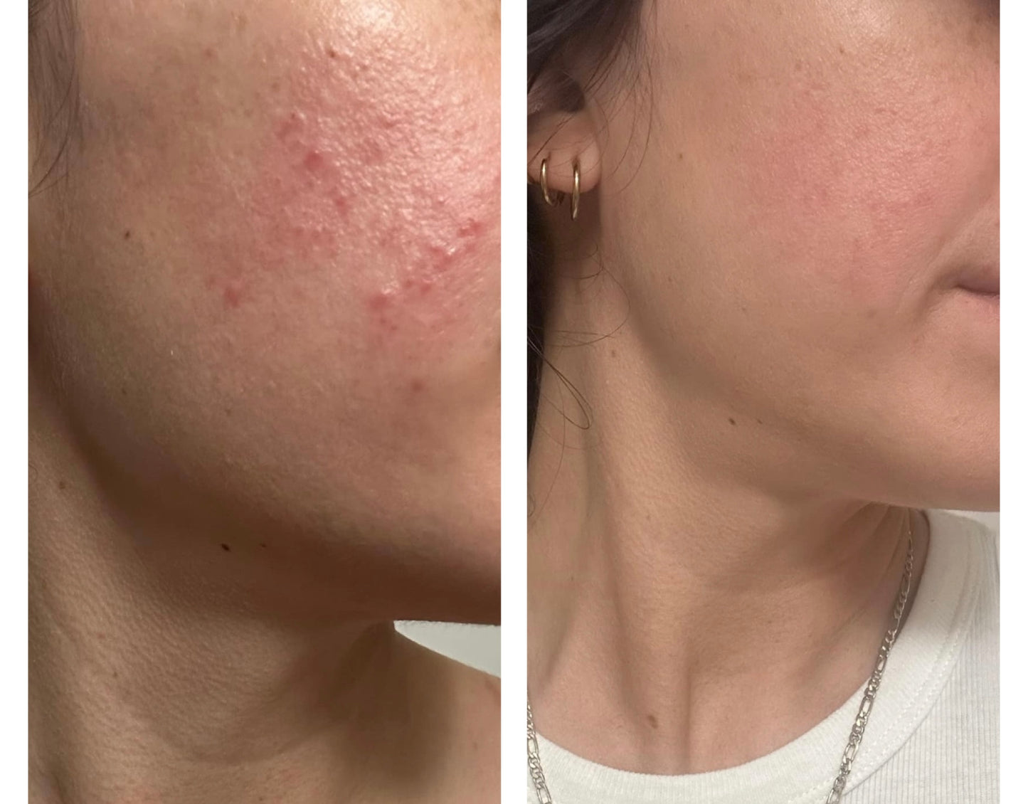 Clarifying Foaming Facewash