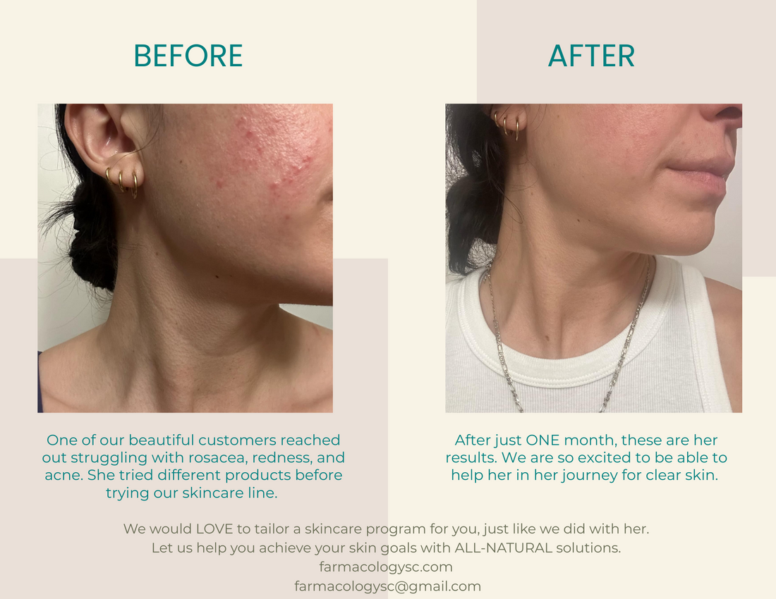 Before and After All-Natural Skincare that WORKS!