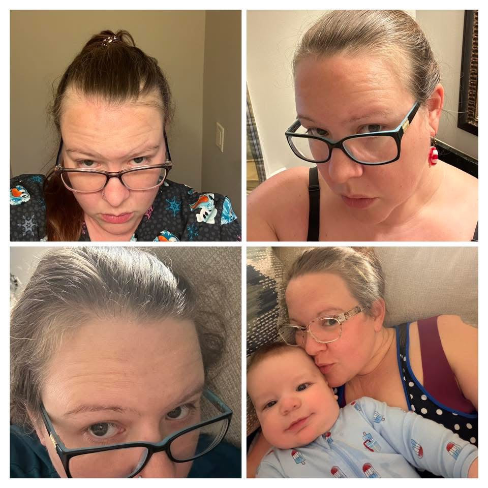 Rosemary Hair Growth Spray